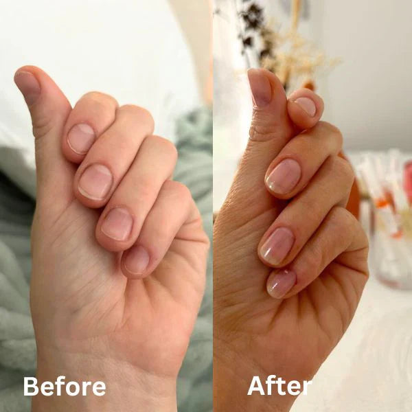 NailBloom™ Repair & Growth Pen