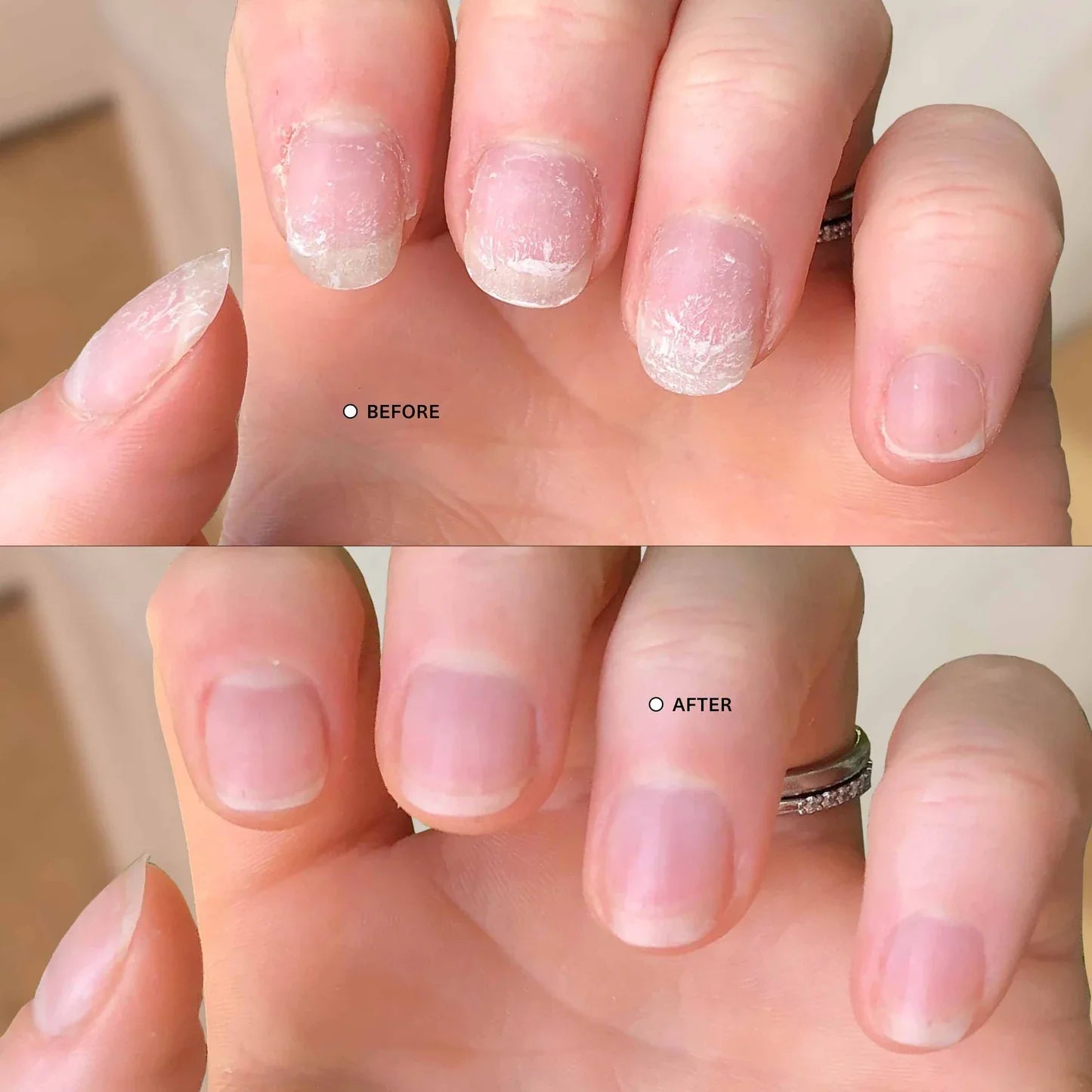 NailBloom™ Repair & Growth Pen
