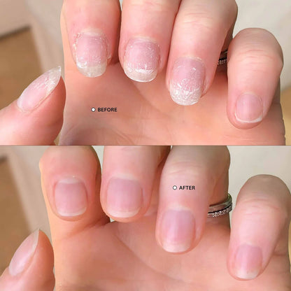 NailBloom™ Repair & Growth Pen