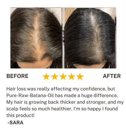 100% Raw Batana Oil